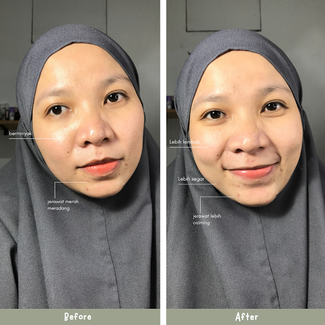 review avoskin facial cleanser, avoskin natural sublime facial cleanser, review facial cleanser avoskin untuk kulit berjerawat, review avoskin facial cleanser untuk kulit sensitif, hasil pemakaian avoskin facial cleanser